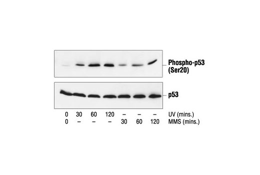 Phospho-p53 (Ser20) Antibody