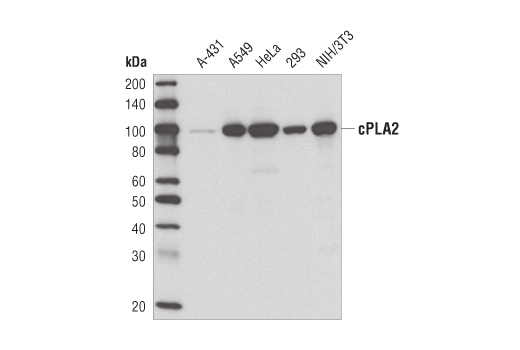 cPLA2 (D49A7) Rabbit mAb