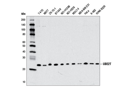 UBE2T (D2L7H) Rabbit mAb