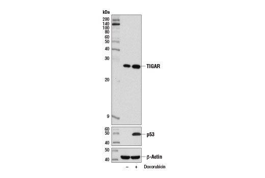 TIGAR (D3F4A) Rabbit mAb
