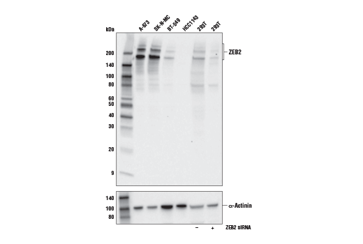 ZEB2 (E6U7Z) Rabbit mAb