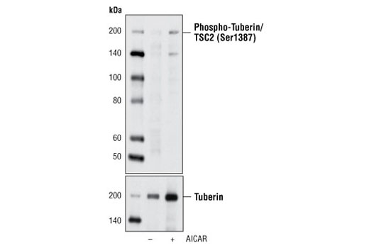Phospho-Tuberin/TSC2 (Ser1387) Antibody