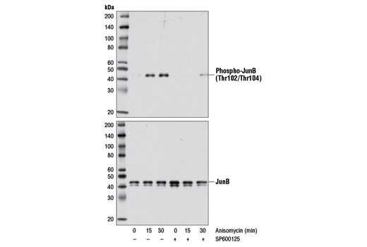 Phospho-JunB (Thr102/Thr104) (D3C6) Rabbit mAb