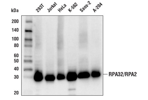 RPA32/RPA2 (E8X5P) XP Rabbit mAb