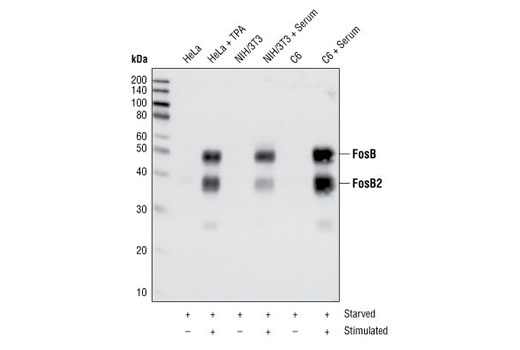 FosB (5G4) Rabbit mAb