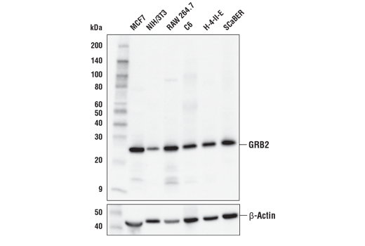 GRB2 (D2M8M) Rabbit mAb