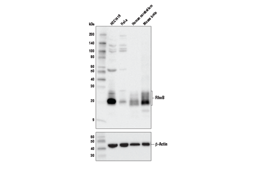 RhoB (D1J9V) Rabbit mAb