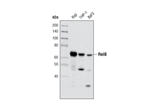 RelB (C1E4) Rabbit mAb
