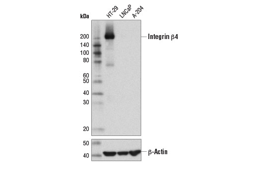 Integrin β4 (D8P6C) XP Rabbit mAb