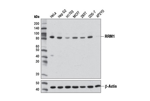 RRM1 (D12F12) XPRabbit mAb