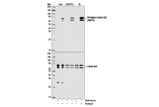 Phospho-Lamin A/C (Ser22) (D2B2E) XP Rabbit mAb