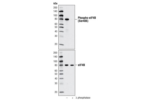 Phospho-eIF4B (Ser406) Antibody