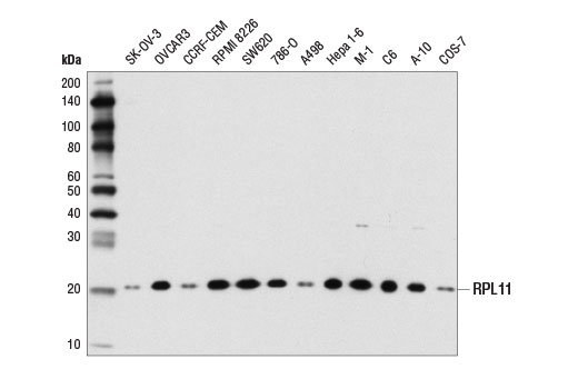 RPL11 (D1P5N) Rabbit mAb