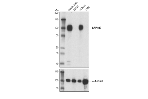 SAP102 (A7R8L) Rabbit mAb