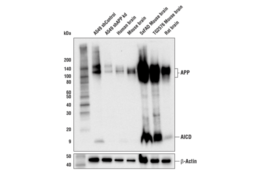 APP (E4H1U) Rabbit mAb