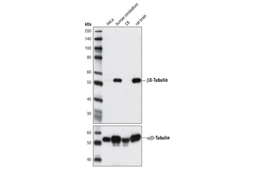 β3-Tubulin (D65A4) XP Rabbit mAb