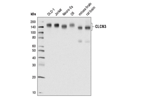 CLCN3 (D8Y5Q) Rabbit mAb