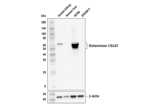 Glutaminase-1/GLS1 (E4T9Q) Rabbit mAb