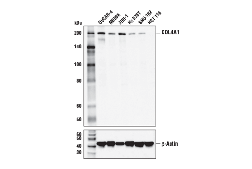 COL4A1 Antibody