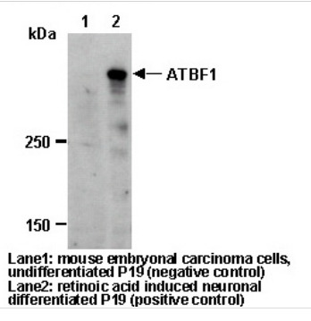Anti-ATBF1 (D1-120) pAb