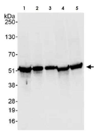 Anti-Calreticulin抗体
