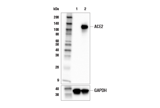 ACE2 (E5O6J) XP<lt/>sup&amp;gt; <lt/>/sup&amp;gt; Rabbit mAb