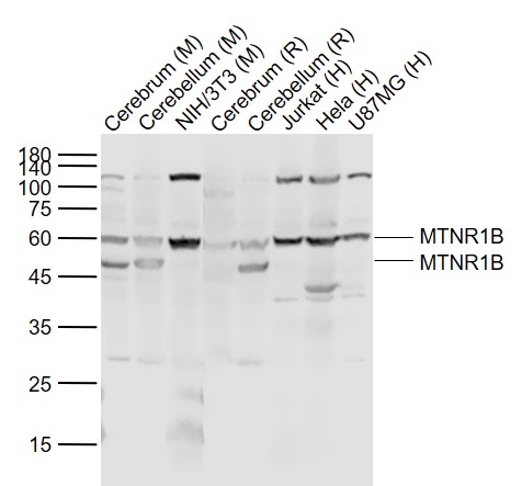 褪黑素受体1B抗体