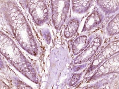 染色质组装因子1P155抗体