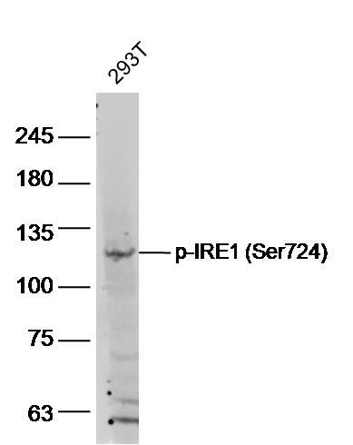 磷酸化IRE1蛋白抗体