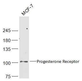 孕激素受体抗体