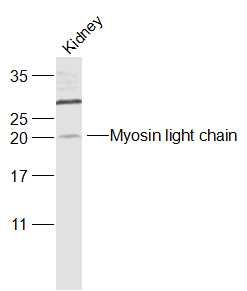 磷酸化肌球蛋白调节多肽9(平滑肌亚型)抗体
