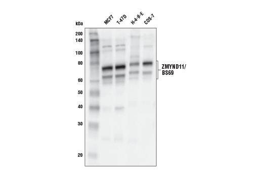 ZMYND11/BS69 (E7P9O) Rabbit mAb