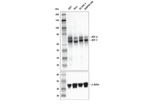 ATF-2/ATF-7 (A9G1M) Rabbit mAb