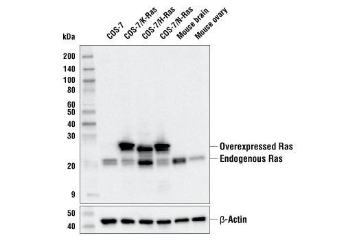 Ras (E8N8L) XP Rabbit mAb