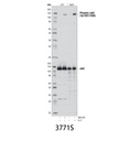 Phospho-Jak2 (Tyr1007/1008) Antibody