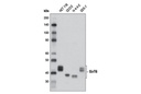 Sirtuin Antibody Sampler Kit