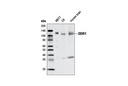 DDR1 (D1G6) XP Rabbit mAb