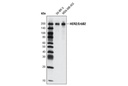 HER2/ErbB2 (M45) Antibody