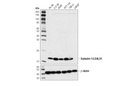 Galectin-1/LGALS1 (8A12) Mouse mAb