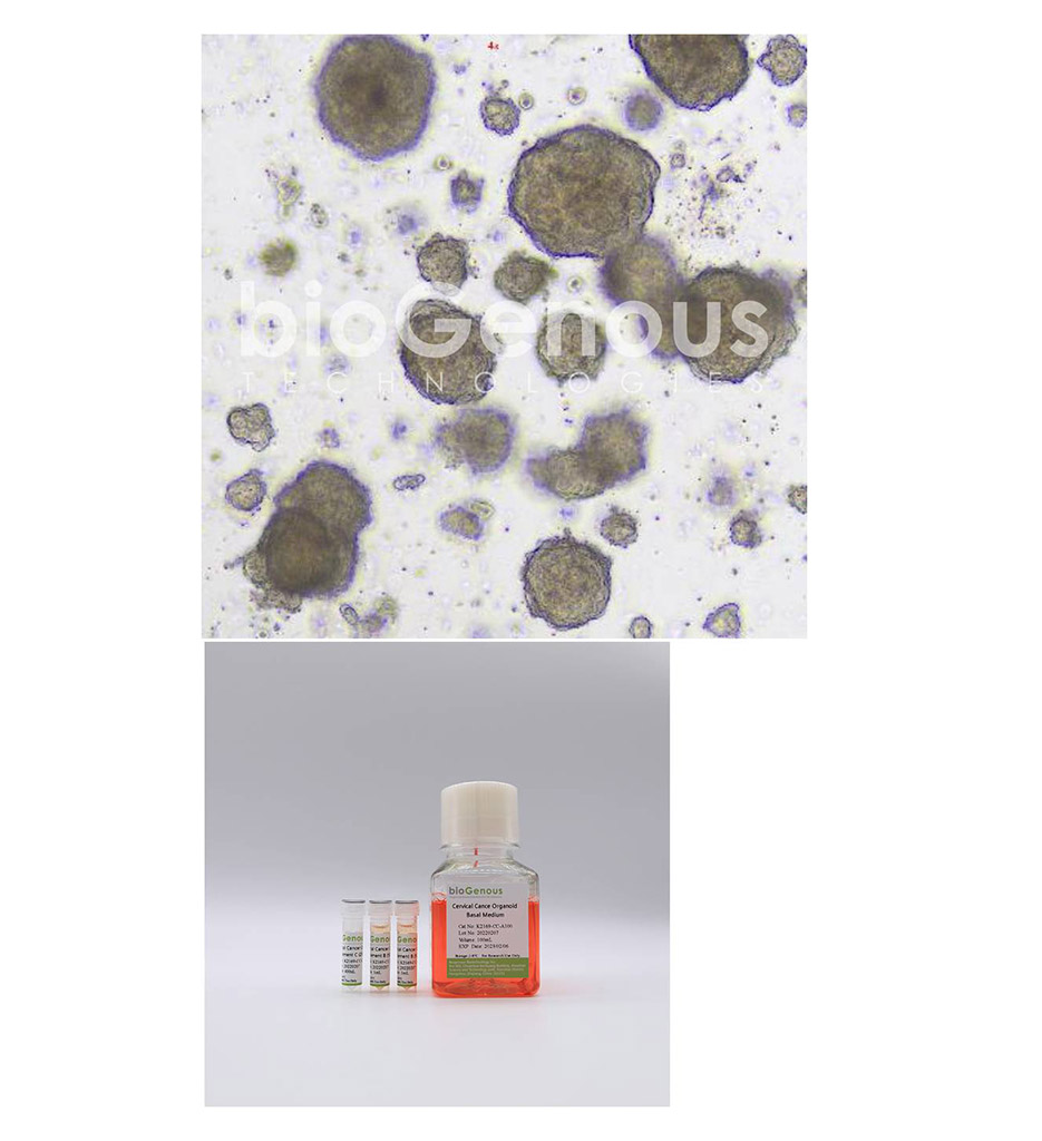 Cervical cancer Organoid Kit宫颈癌
