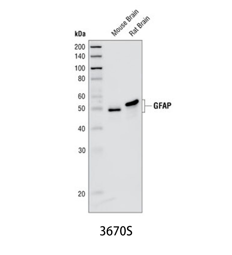 GFAP (GA5) Mouse mAb