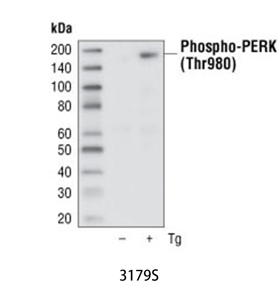 Phospho-PERK (Thr980) (16F8) Rabbit mAb