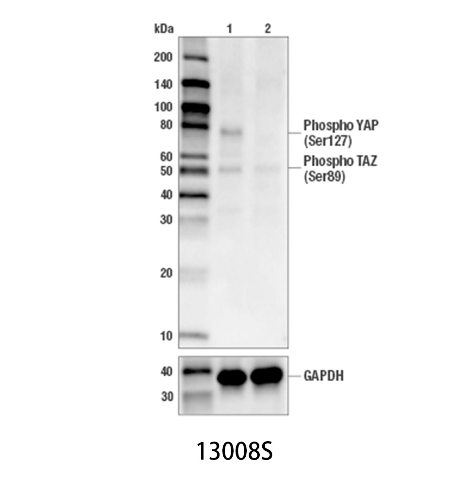 Phospho-YAP (Ser127) (D9W2I) Rabbit mAb