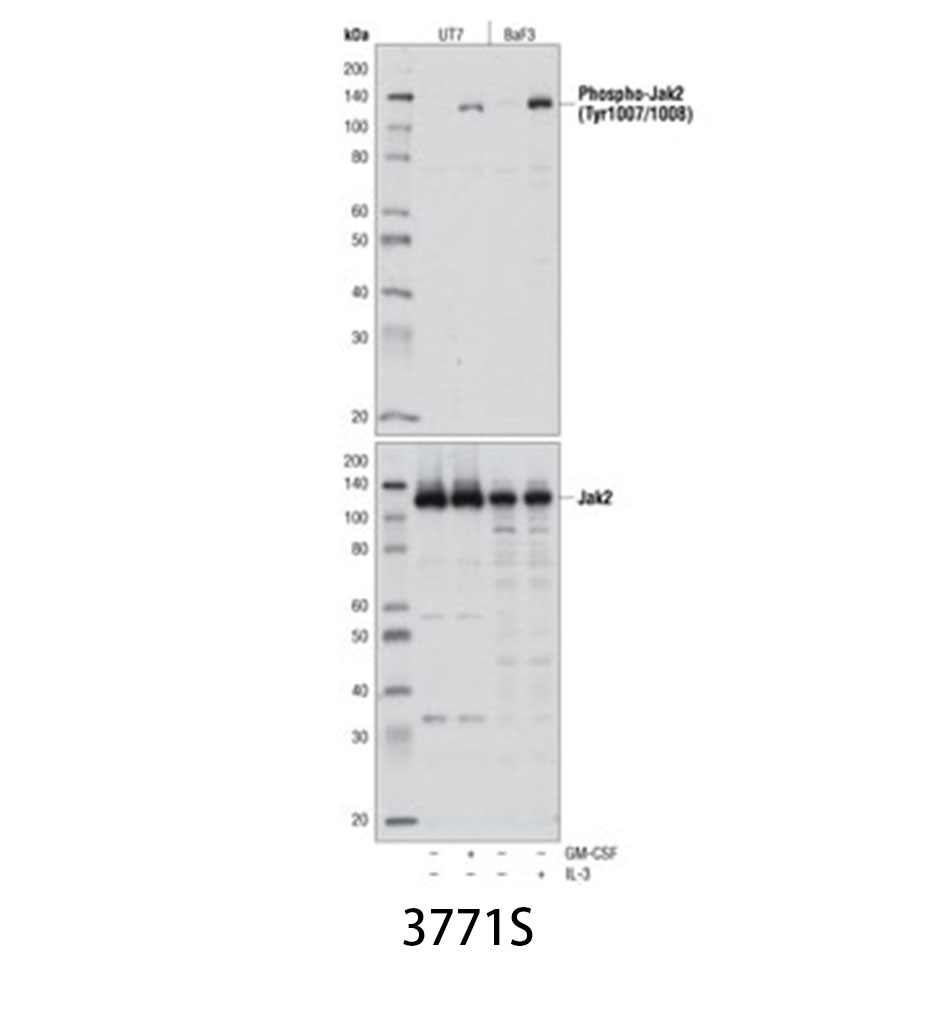 Phospho-Jak2 (Tyr1007/1008) Antibody