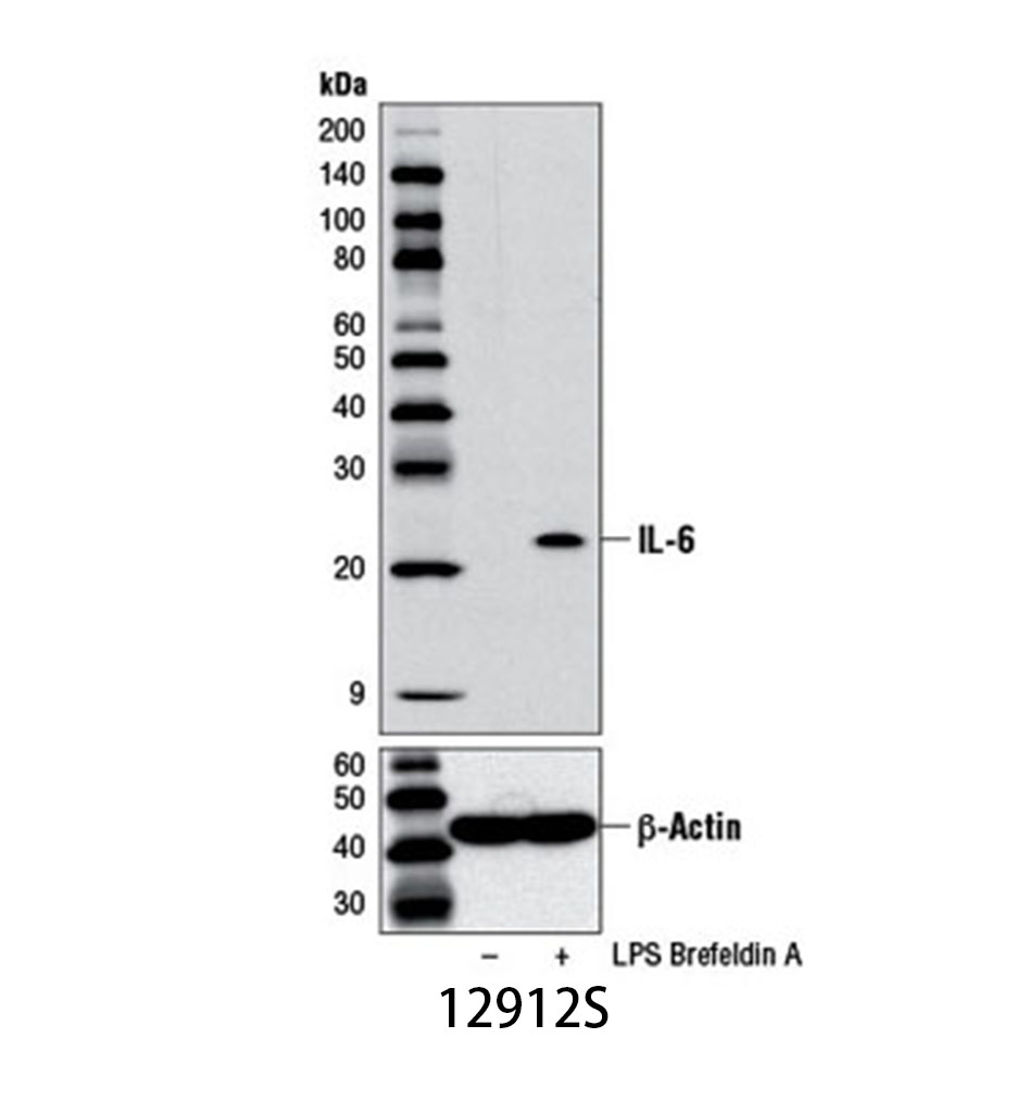 IL-6 (D5W4V) XP Rabbit mAb (Mouse Specific)