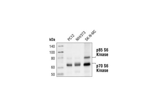 p70 S6 Kinase (49D7) Rabbit mAb