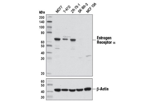 Estrogen Receptor α (D8H8) Rabbit mAb
