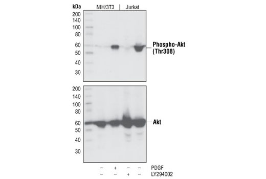 Phospho-Akt (Thr308) (C31E5E) Rabbit mAb