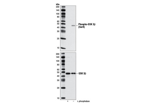 Phospho-GSK-3β (Ser9) Antibody