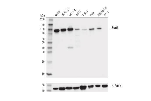 Stat5 (D3N2B) Rabbit mAb